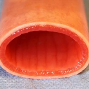 Wet Bowel Section - Double Layer