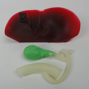 Liver, Gallbladder & common Bile Duct