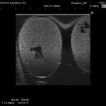 Ultrasound Scrotal Phantom - Image 4