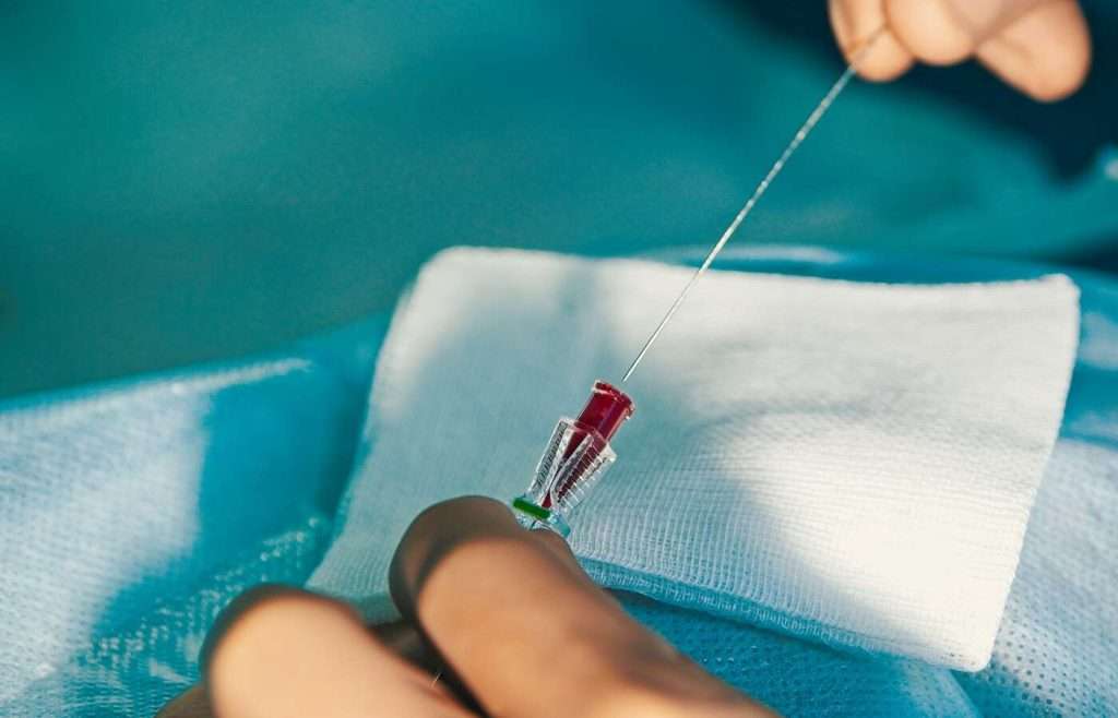 Radial Artery Puncture